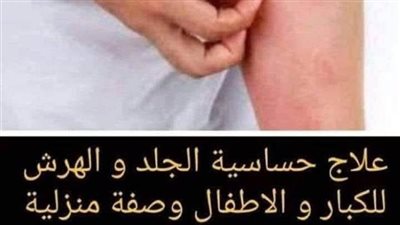 وصفة منزلية سهلة وبسيطة موجودة في كل بيت للتخلص من حساسية الجلد و ال هرش والنتيجة من اول يوم