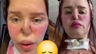 نجمة من ستار أكاديمي يتعرض وجهها للتشوه بسبب السحر