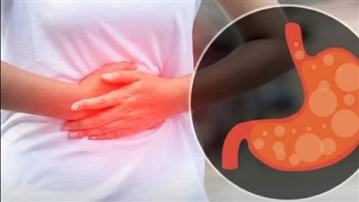 7 أسباب مفاجئة لكثرة إطلاق الريح- هل تستدعي القلق؟